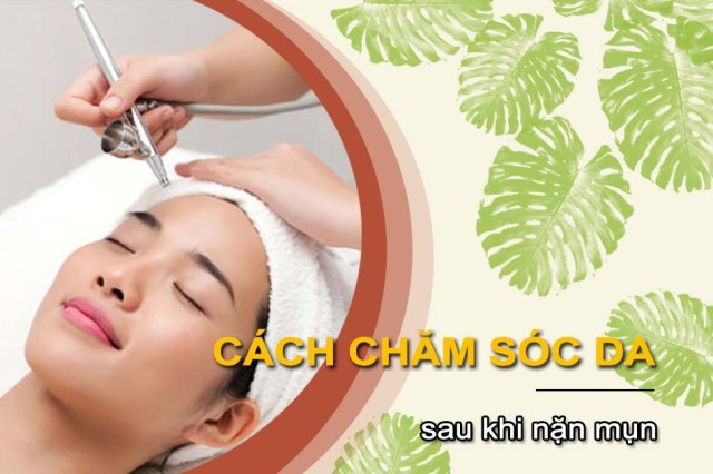 Cách chăm sóc da mặt sau khi nặn mụn tại nhà đơn giản nhất