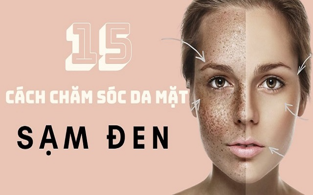 15 cách chăm sóc da mặt bị sạm đen đơn giản, hiệu quả bất ngờ  