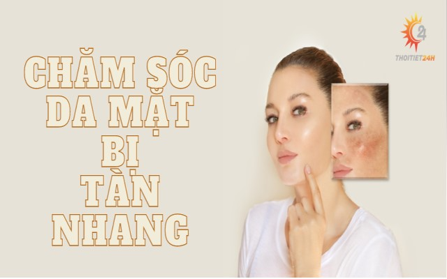 Bỏ túi cách chăm sóc da mặt bị tàn nhang khoa học và hiệu quả