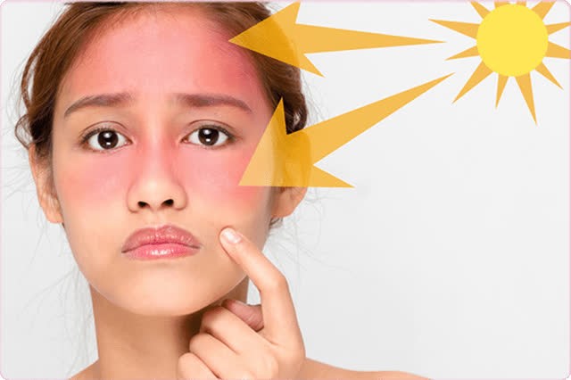 Da mặt chịu ảnh hưởng bởi nhiều yếu tố môi trường 
