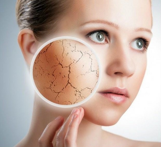 Cách nhận biết da mặt bạn thuộc loại da khô