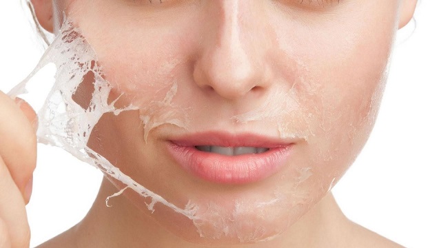 Nguyên nhân nào khiến da mặt bạn bị khô