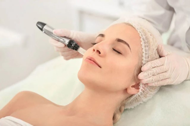 Hạn chế dùng phương pháp laser để chăm sóc da sau nặn mụn  