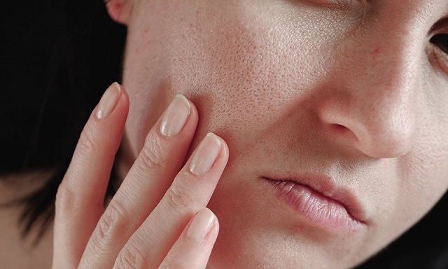 Tình trạng da khô xuất hiện nhiều khi bạn bước vào tuổi trung niên
